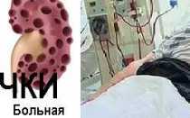 Лечение гипертонии при хпн — Лечение гипертонии