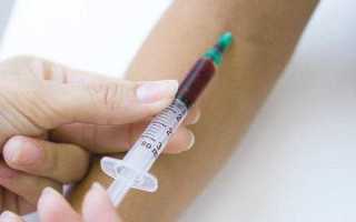 Срок годности анализов для госпитализации урология