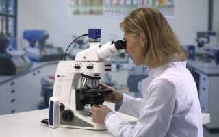 Лейкоциты в крови при болезни почек