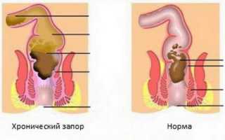 Почему после секса хочется в туалет: причины