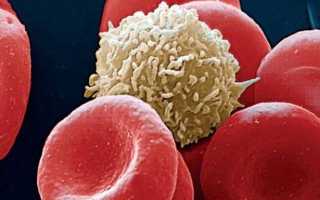 Лейкоциты в моче у ребенка повышены: причины. О чем говорят повышенные лейкоциты в моче у ребенка