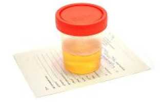 Повышены лейкоциты в моче — причины и к какому врачу обращаться