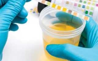 Определение, причины и симптомы ацетона в моче. Лечение ацетона в моче у взрослых, детей и беременных. Ацетон в моче взрослых и детей