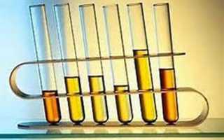 Сколько делается анализ мочи общий