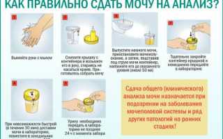 Расшифровка анализа мочи по методу Нечипоренко: норма и возможные заболевания