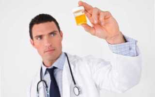 Повышена относительная плотность мочи что это значит