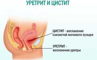 Эпителий плоский в моче — что это значит?