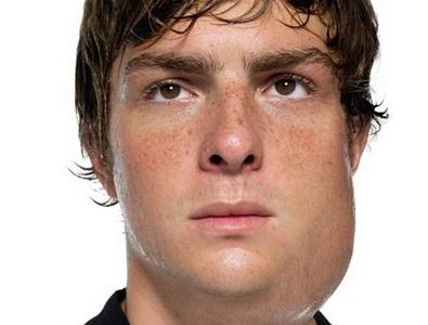 воспаление околоушных слюнных желез