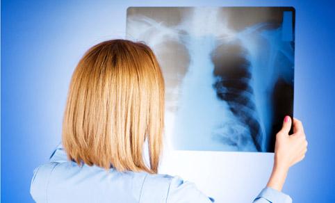 mozhno-li-pnevmoniyey-zarazit'sya-kapel'nym-vozdushno-putem