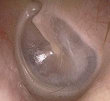 -лопнули перепонки в ушах