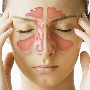 как вылечить гайморит без антибиотиков у взрослого