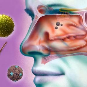 симптомы и лечение полипозного риносинусита