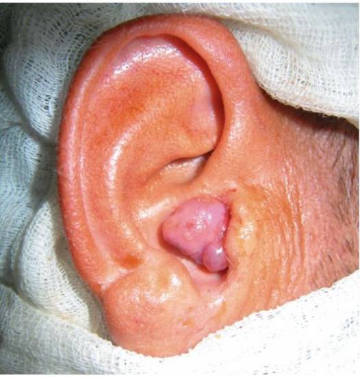 Что делать если шумит в ушах.