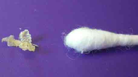 пробка в ухе как убрать