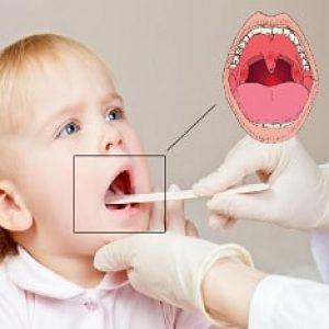 Сколько дней заразна ангина для окружающих