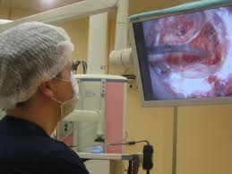 отосклероз уха-2