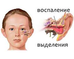 как проявляется отит
