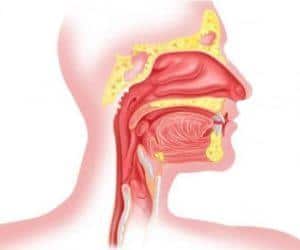 Чем лечить боль в горле при глотании