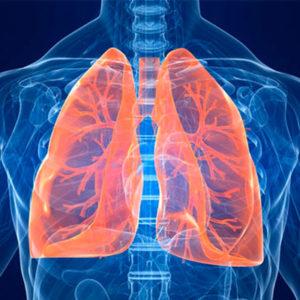 Что такое пневмоторакс