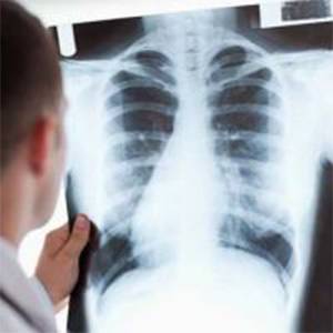 Что такое пневмоторакс