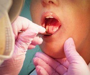 Чем отличается ангина от фарингита