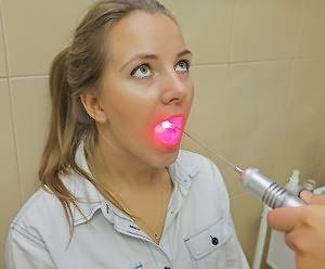 Что делать для профилактики тонзиллита