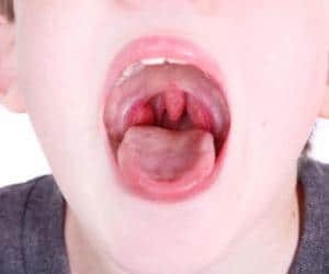 Что делать, если больно глотать, но горло не болит