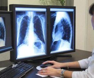 Что показывает рентген грудной клетки