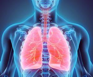 Что такое адгезивный плеврит и как его лечить