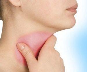 Что такое стеноз гортани и как его лечить