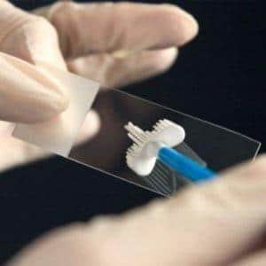 Что такое стрептококк пиогенес