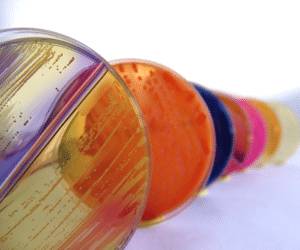 Что такое стрептококк пиогенес