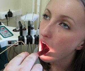 Что такое стридор