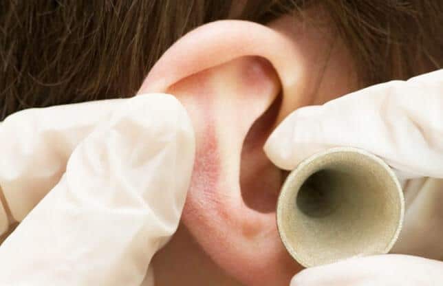 belaya-sera-v-ushakh-prichiny