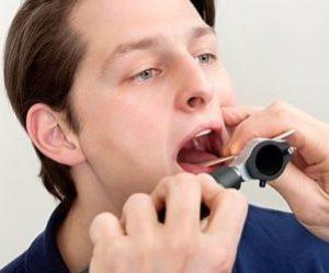 Как делают криотерапию миндалин