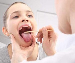 Как лечить декомпенсированный тонзиллит