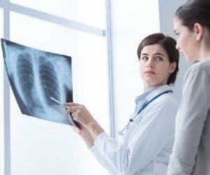 Как лечить экссудативный плеврит