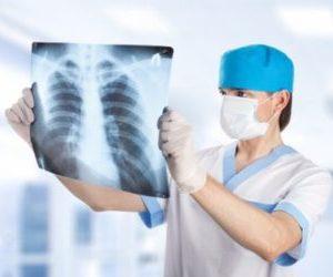 Как лечить пневмофиброз