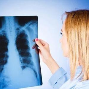 Как лечить пневмосклероз