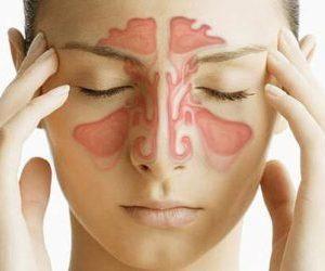 Как лечить постназальный синдром