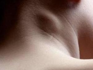Как лечить шейный лимфаденит