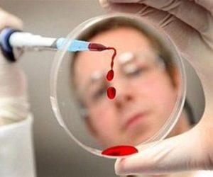 Как лечить свиной грипп