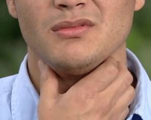 Как лечить вирусную ангину у взрослых