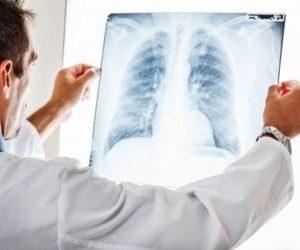 Как лечить вирусный кашель