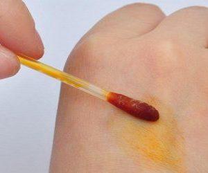 Как правильно делать йодовую сетку ребенку при кашле?