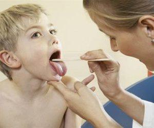 Как принимать Аугментин при ангине