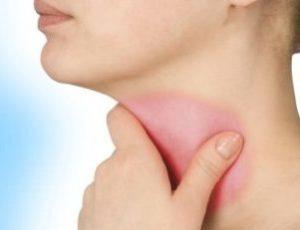 Какие ангины бывают