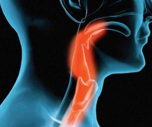 Какой спрей для горла лучше при ангине