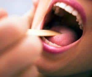 Лечение ангины у беременных на ранних сроках