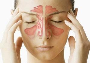 Лечение лобных пазух